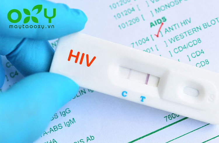 Người nhiễm HIV có nhiều khả năng bị lao