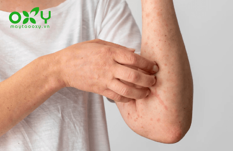 Cơ thể bị ngứa không rõ nguyên nhân đôi khi là dấu hiệu ban đầu cảnh báo bệnh lý về da