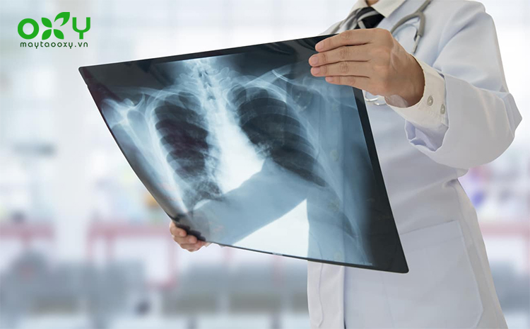 Thuyên tắc phổi làm hạn chế luồng không khí lưu thông gây tức ngực khó thở khi nằm