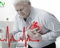 Mọi thứ bạn cần biết về nhịp tim nhanh